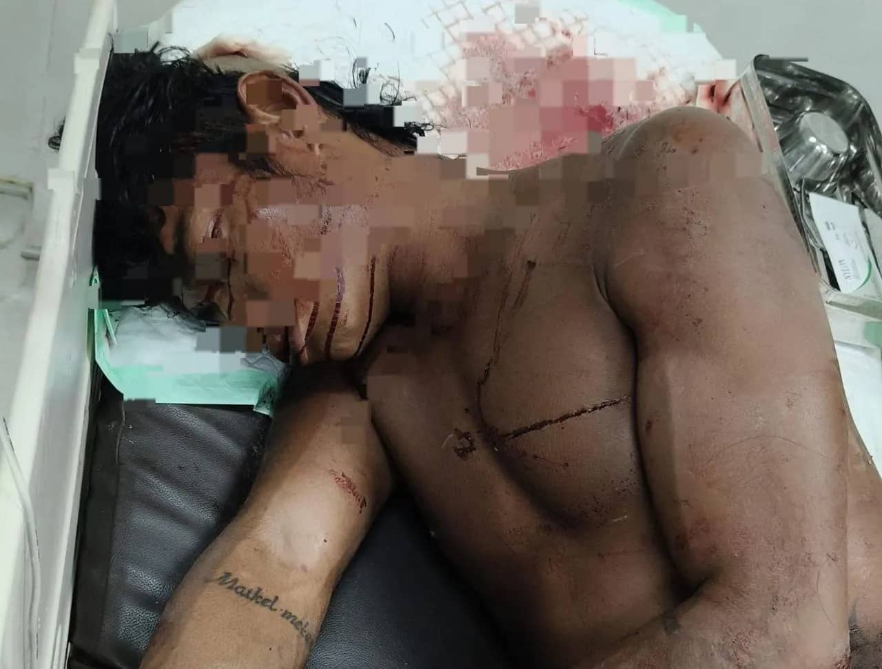 Ilustrasi berita Mimika: Diduga Jadi Korban Penganiayaan, Seorang Pria Tergeletak dengan Sejumlah Luka di Jalan Yos Sudarso Timika