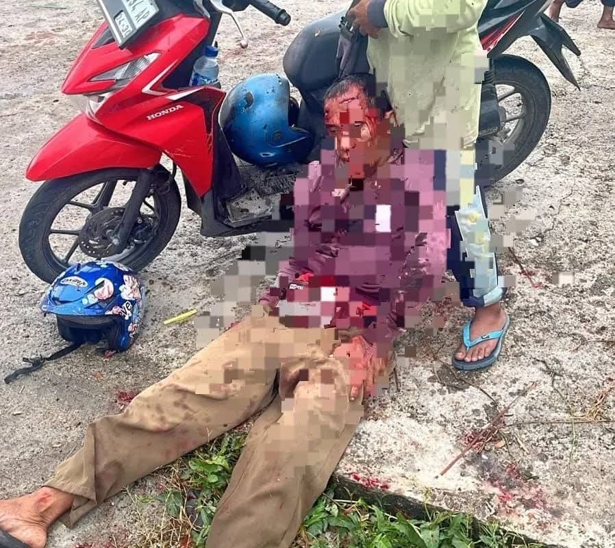Ilustrasi berita Papua Tengah: Tukang Ojek Dibacok di Bagian Kepala oleh Dua Orang Tak Dikenal di Nabire