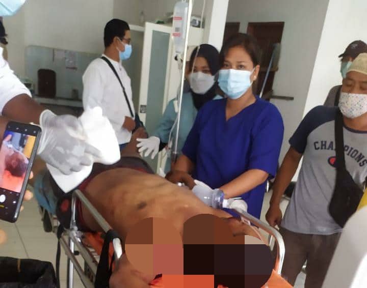 Ilustrasi berita Mimika: Warga Jember Tewas Dianiaya di Yahukimo, Korban Alami Luka Sabetan Benda Tajam di Kepala