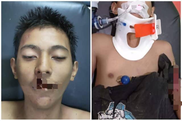 Ilustrasi berita Mimika: Remaja yang Meninggal Akibat Kecelakaan di Jalan Budi Utomo Ujung Ternyata Pelajar SMP Negeri 2 Timika