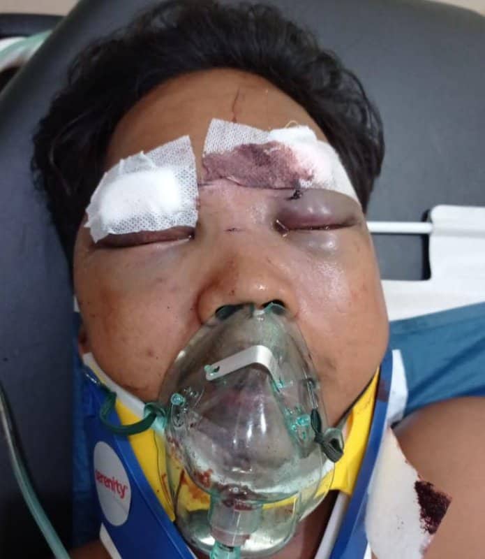 Ilustrasi berita Mimika: Seorang Pria Kritis Ditemukan di Kilometer 8, Dokter RSUD Mimika Lakukan Operasi, Mungkin Ada yang Kenal ?