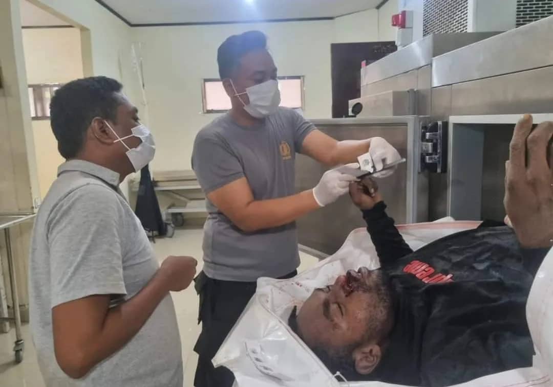 Ilustrasi berita JAYAPURA: Terbaring di Ruang Jenazah RS Bhayangkara, Identitas Korban Kecelakaan Hingga Kini Belum Terungkap