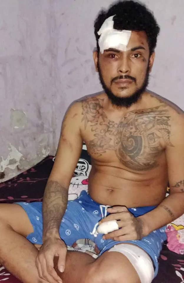 Ilustrasi berita Mimika: Gerardus Ceritakan Kronologis Penganiayaan Sadis yang Dilakukan Dua Oknum Pegawai Lapas Timika, Keluarga Tuntut Satu Lagi Ditangkap