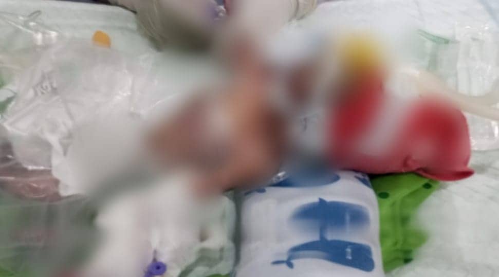 Ilustrasi berita Mimika: Menggegerkan, Bayi Perempuan Dibuang di Tempat Sampah RSUD Mimika