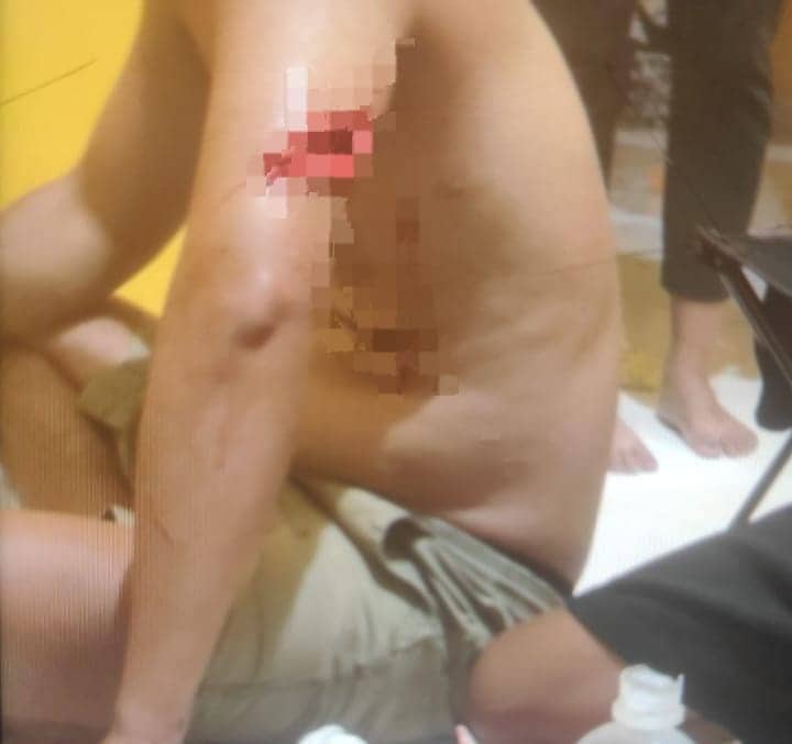 Ilustrasi berita Mimika: Teror Landa Timika, Seorang Pria Jadi Korban Pembacokan di Nawaripi Dalam, Pengendara Avanza Hitam Dilepas