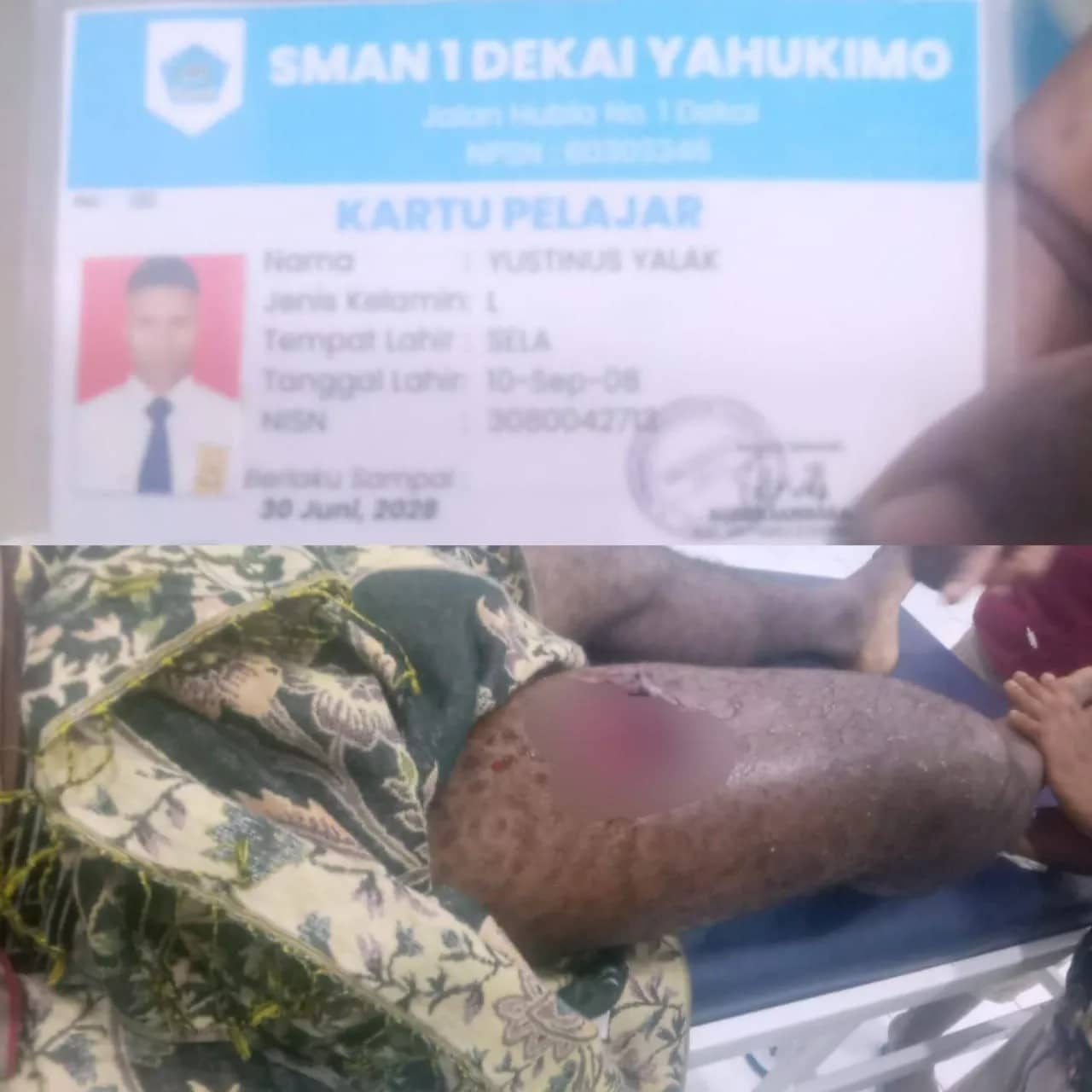 Korban bernama Yustinus Yalak (18), pelajar SMA Negeri 1 Dekai.