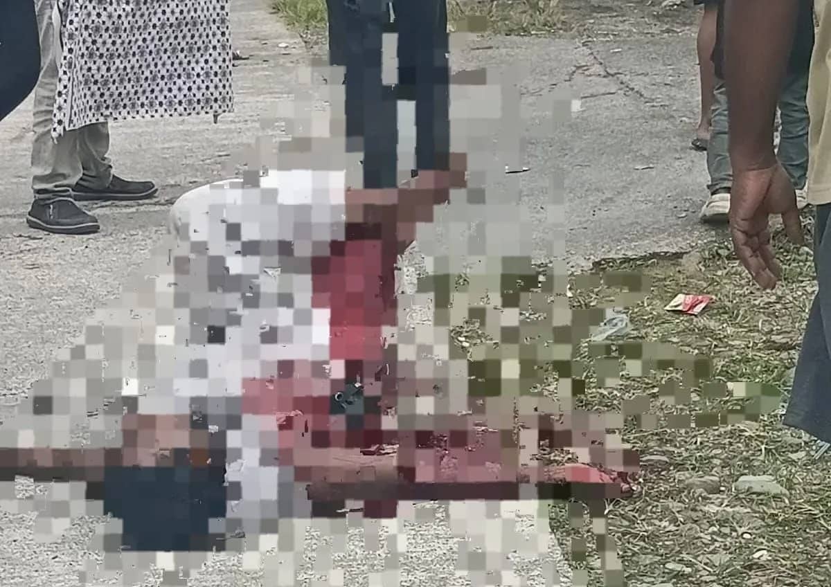 Korban dilarikan ke RSMM usai tangan kanannya terluka.