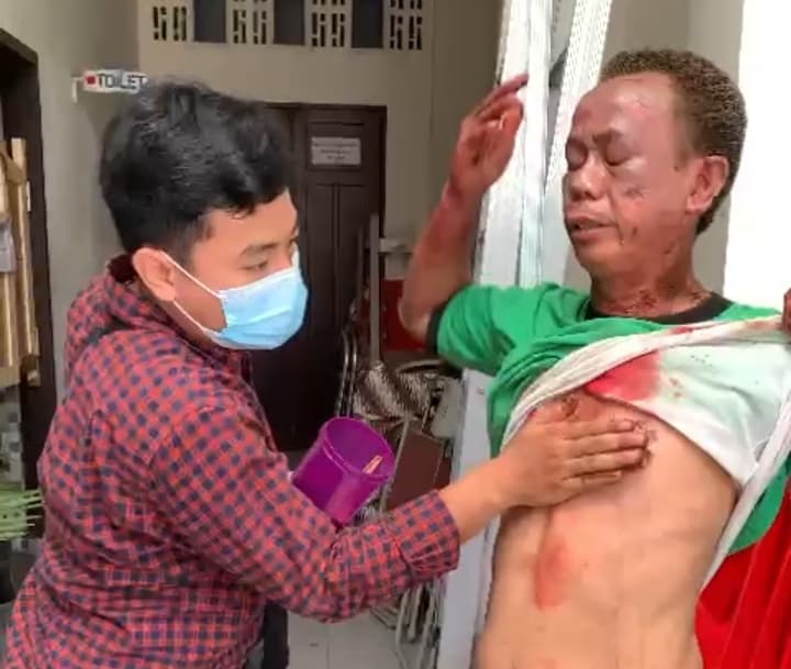 Ilustrasi berita NASIONAL: Ledakan Bom di Gereja Katedral Makassar, Ini Jumlah Korban Meninggal, Mujur Pelaku Dihalangi Petugas Gereja