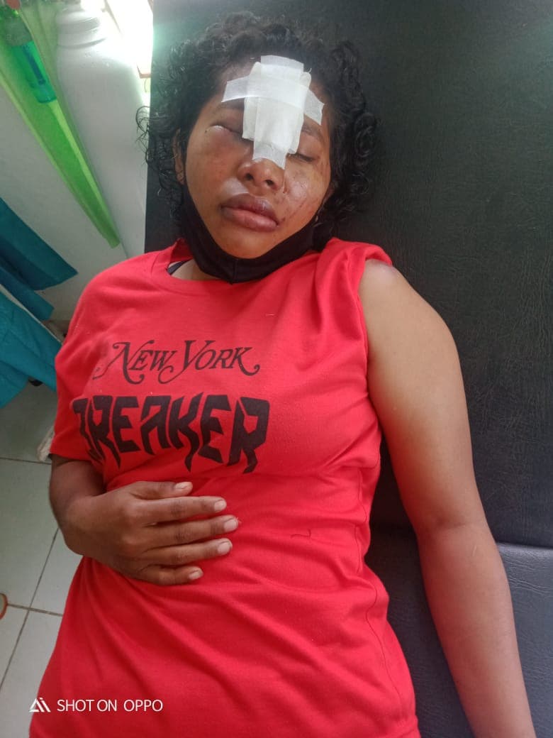 Guru SD YPPK Muare yang dirampok seorang pria