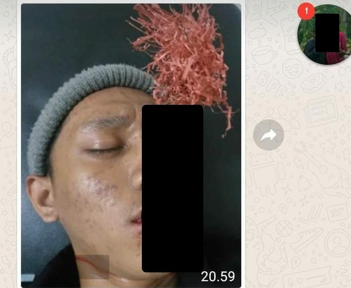 Foto Korban Terkena Panah Waer