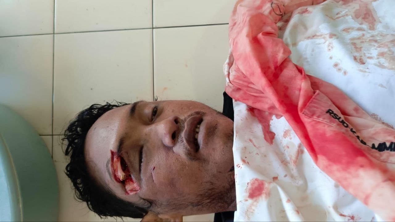 Ilustrasi berita MIMIKA: Mayat Pria Ditemukan di Bawah Kolong Truk di Jalan Irigasi Ujung Timika