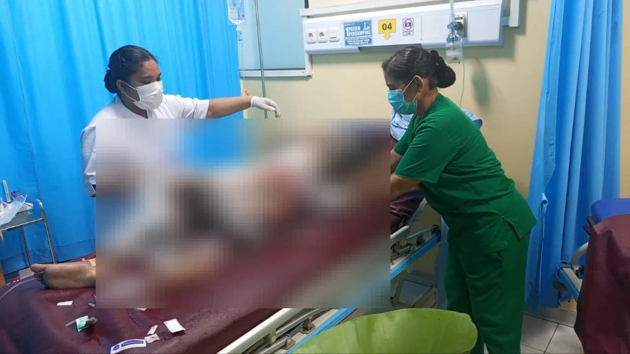 Ilustrasi berita JAYAPURA: Seorang Ibu Diduga Bakar Anak Kandung hingga Tewas di Sentani Timur