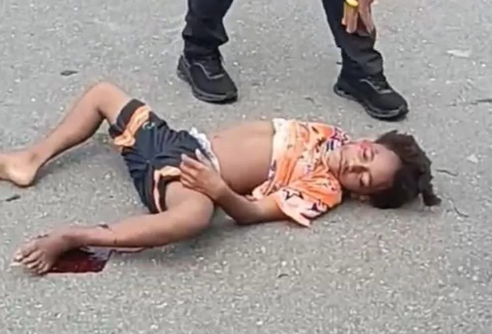 Ilustrasi berita Mimika: Laka Lantas di Jalan Poros SP 5 Timika, Seorang Anak Tidak Sadarkan Diri Usai Motor Bertabrakan dengan Mobil
