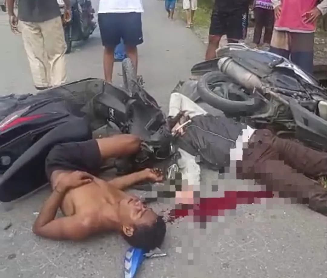 Ilustrasi berita Mimika: Laka Lantas Libatkan Dua Sepeda Motor di Jalan Duku SP 2 Timika, Dua Korban Tergeletak Bersimbah Darah