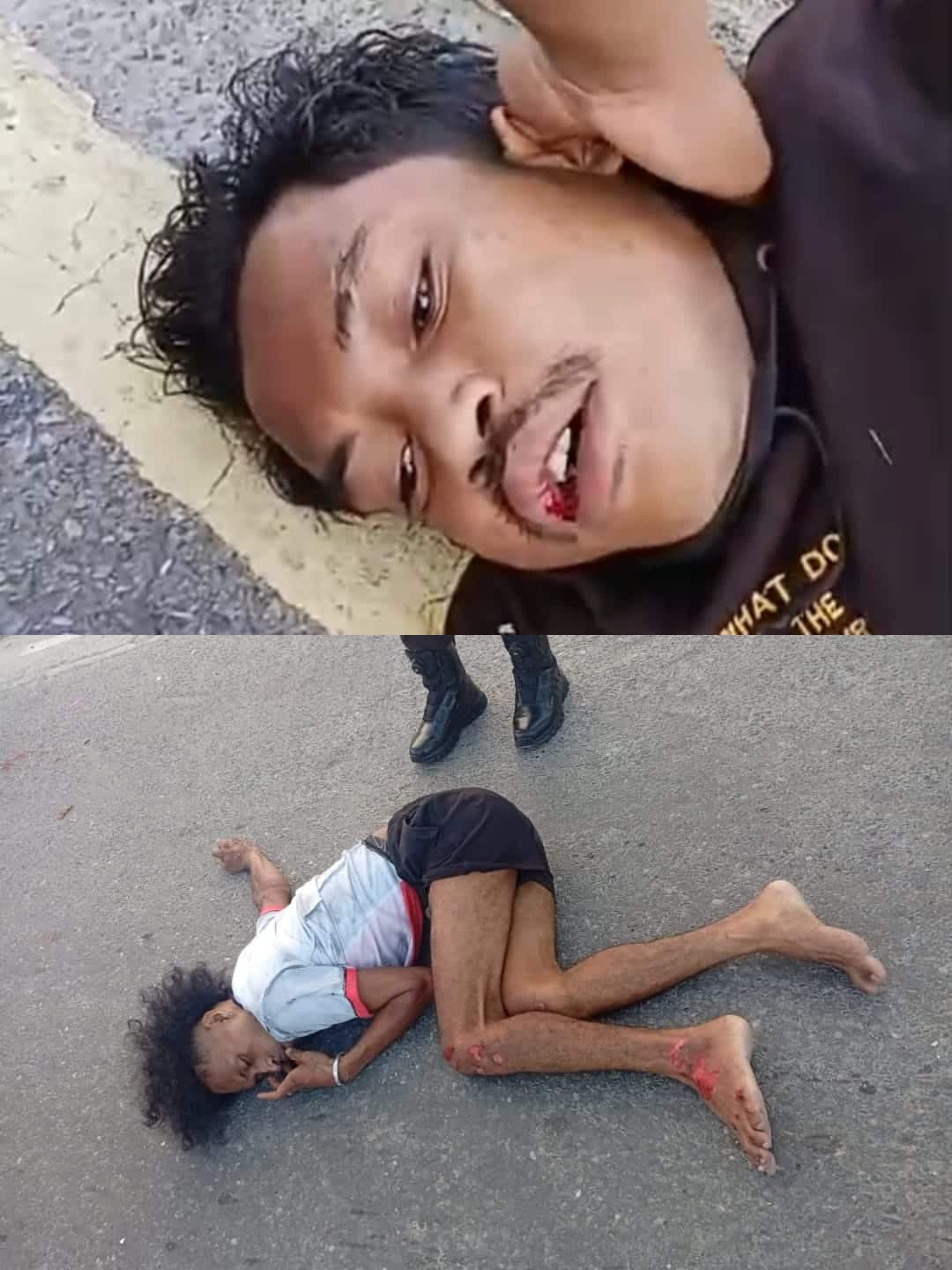 Ilustrasi berita MIMIKA: Lakalantas di Jalan Yos Sudarso Timika, Dua Orang Tergeletak, Satu Orang Patah Kaki
