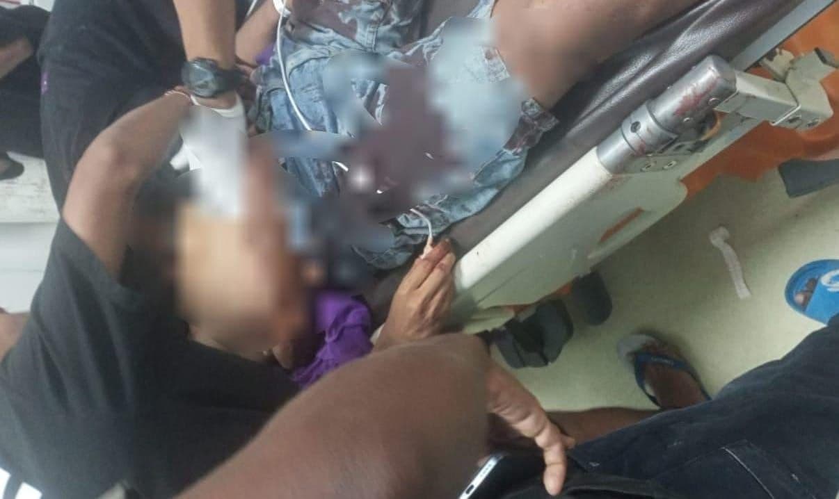 Ilustrasi berita MIMIKA: Aksi Angkat Ban Berujung Kecelakaan, Pengendara Motor Tabrak Pejalan Kaki di Jalan Yos Sudarso Timika