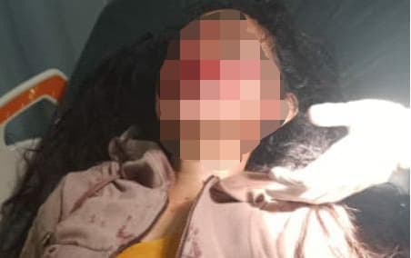 Ilustrasi berita MIMIKA: Masih Ingat Wanita Korban Jambret yang Dilarikan ke RSUD Mimika Semalam? Begini Kondisinya Sekarang