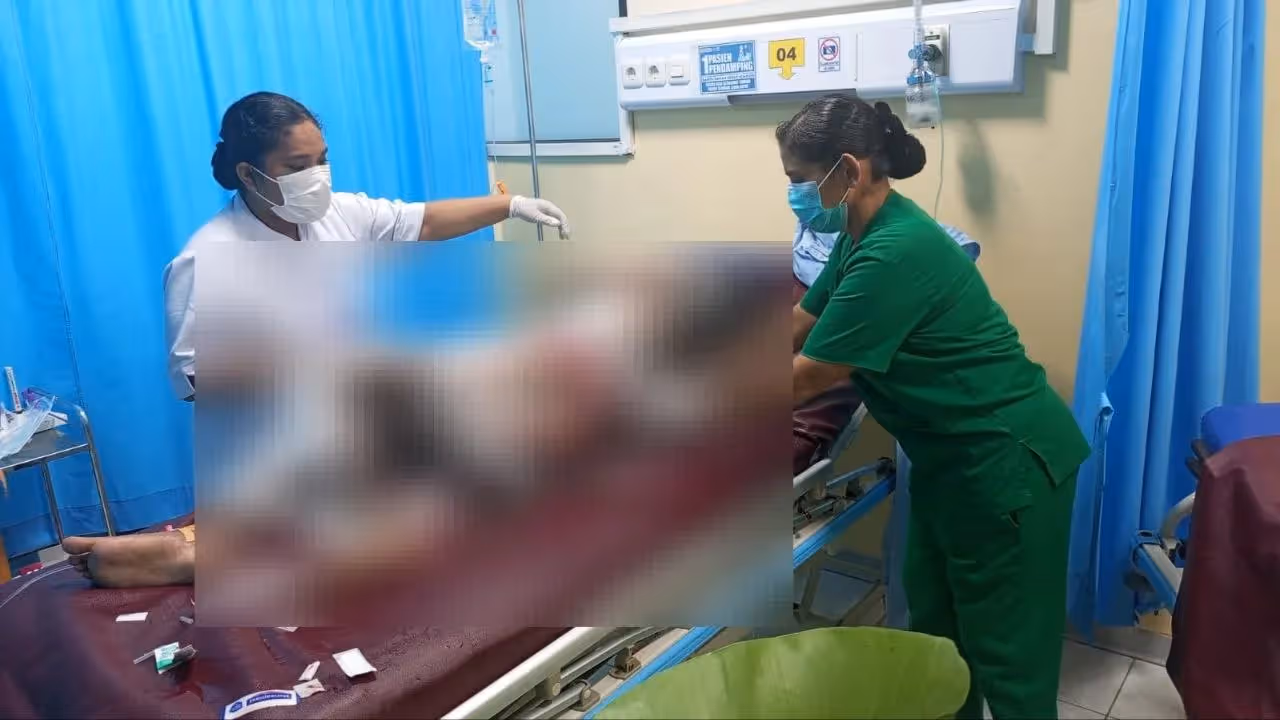 Korban yang dibakar ibu kandungnya hingga meninggal dunia di Sentani Timur, Kabupaten Jayapura.