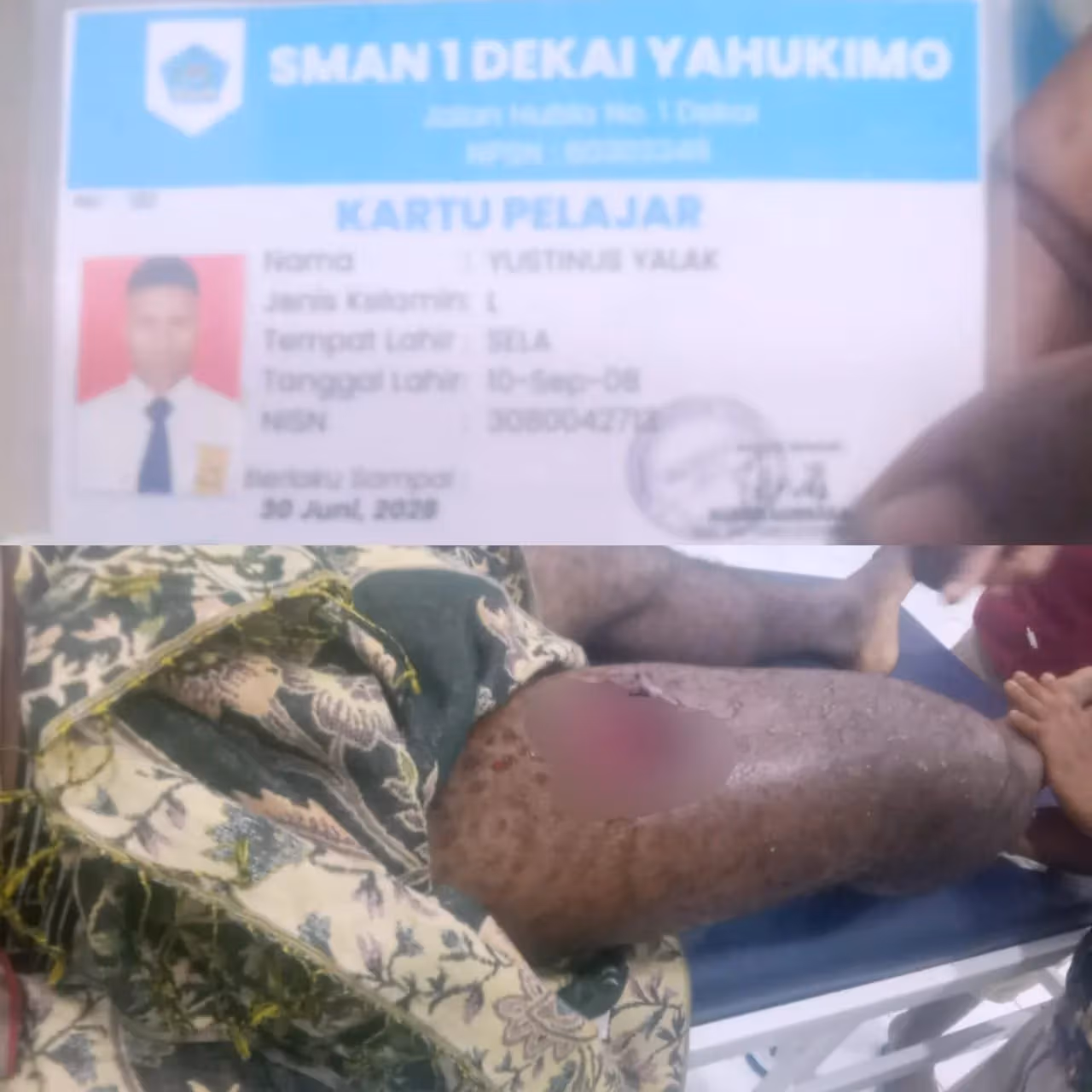 Ilustrasi berita Papua: TPNPB OPM Klaim Pelajar SMA Negeri 1 Dekai Jadi Korban Penembakan Saat Operasi Aparat di Yahukimo