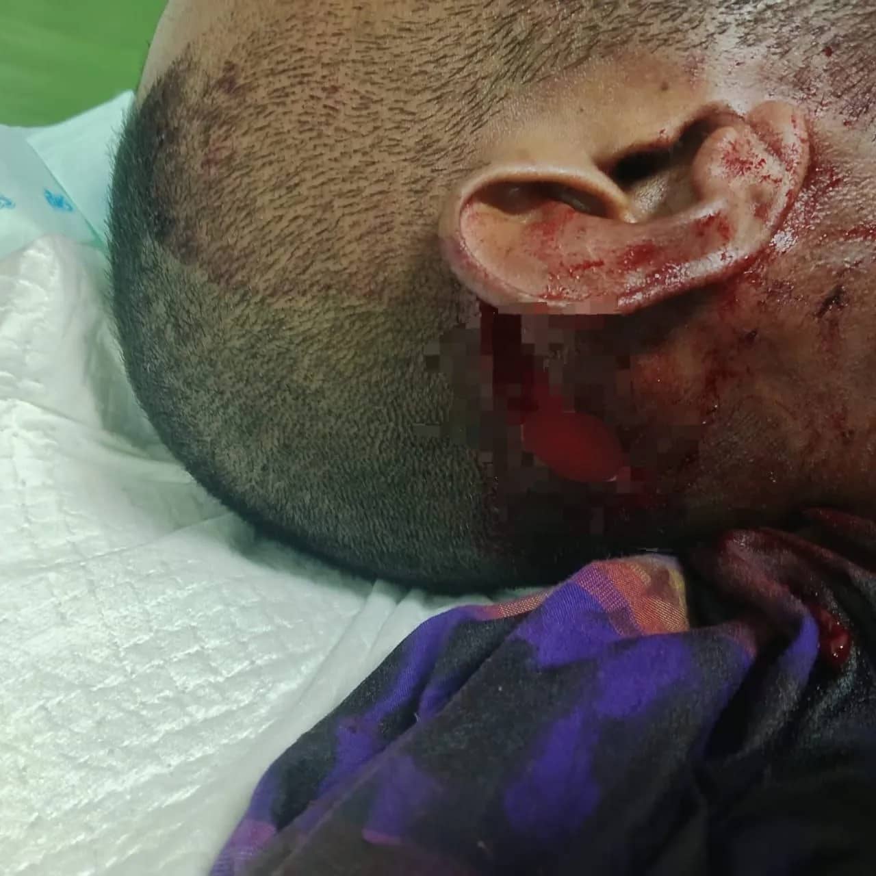 Korban pembacokan di Jalan Perintis, Timika.