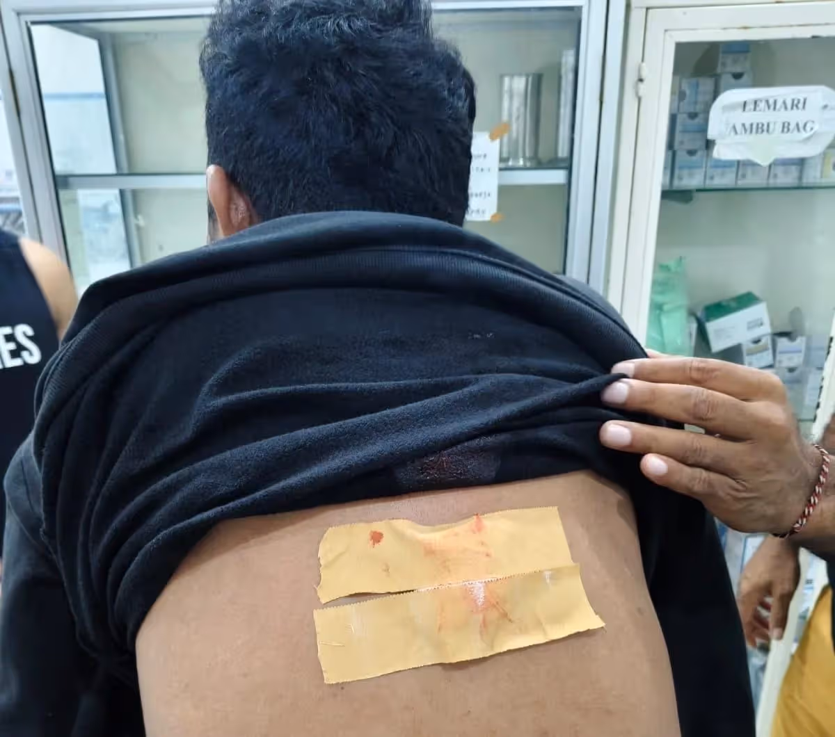Korban penikaman, Harianto (35), saat mendapatkan perawatan medis di RSUD Dekai setelah diserang orang tak dikenal di Jalan Sosial, Distrik Dekai, Kabupaten Yahukimo, Selasa (27/10/2026) sore.