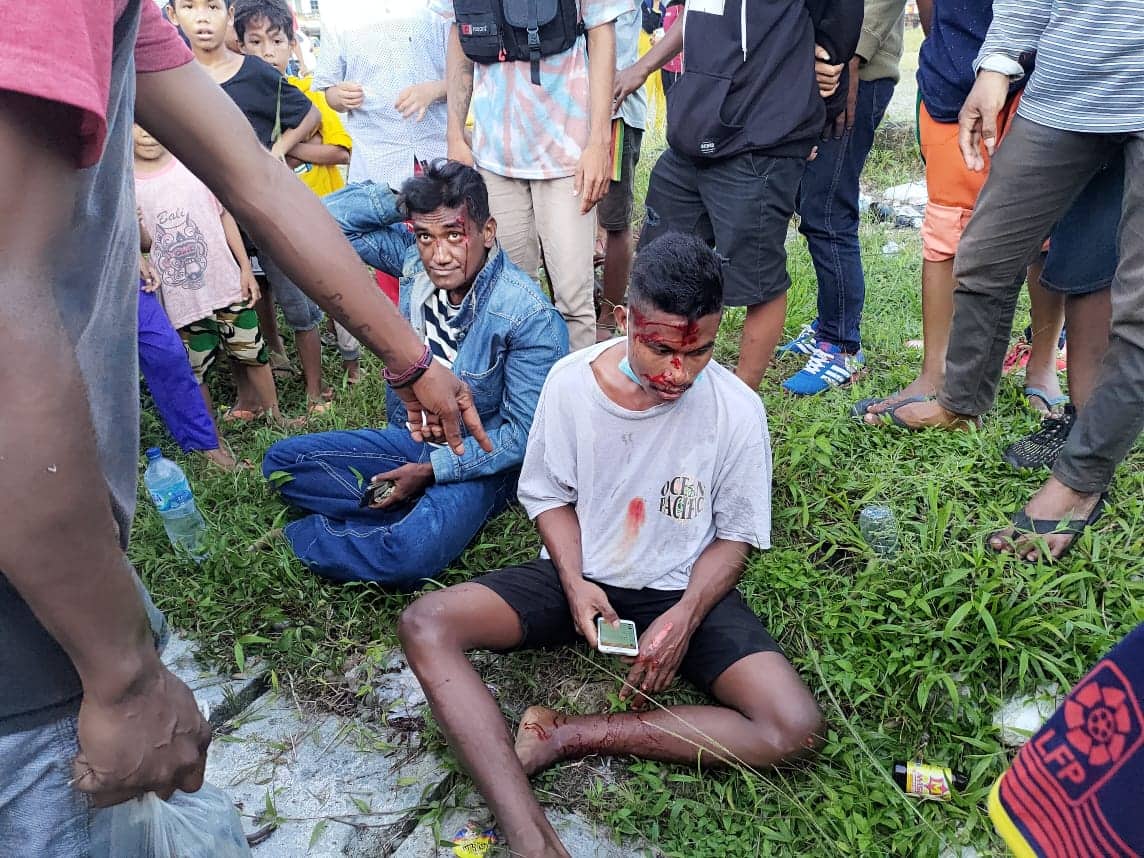 Ilustrasi berita Mimika: Ugal-ugalan di Jalan, Pengendara Tabrak Pejalan Kaki, Alami Luka Sekujur Tubuh