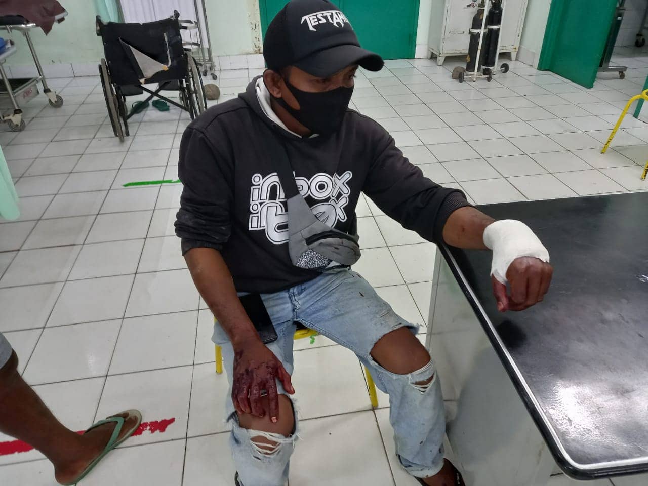 Tangan kiri korban luka parah setelah disabet parang.