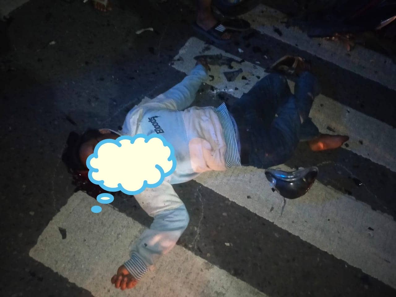 Dua kaki korban patah.