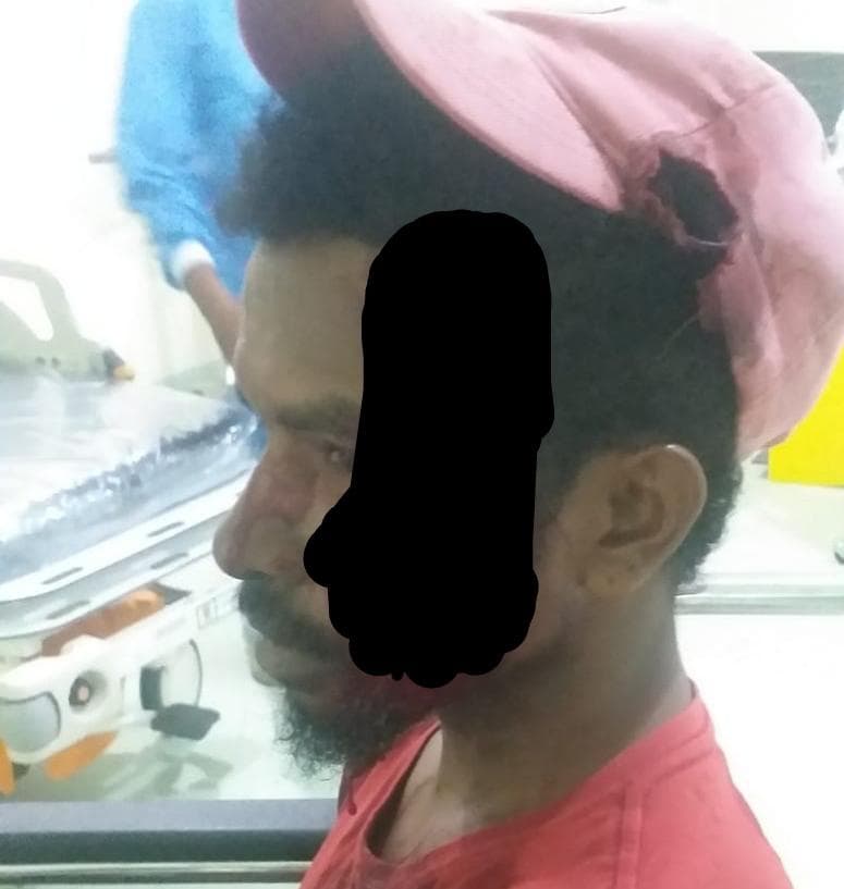 Ilustrasi berita MIMIKA: Hendak Naik Dulang, Edoardus Diparangi Saudaranya di Kepala Hingga Masuk RSUD Mimika