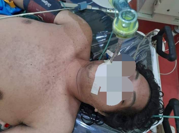 Ilustrasi berita Mimika: Identitas Mr. X Sudah Terungkap, Ternyata Korban Laka Tunggal yang Nyemplung ke Kolam Ikan SP 1