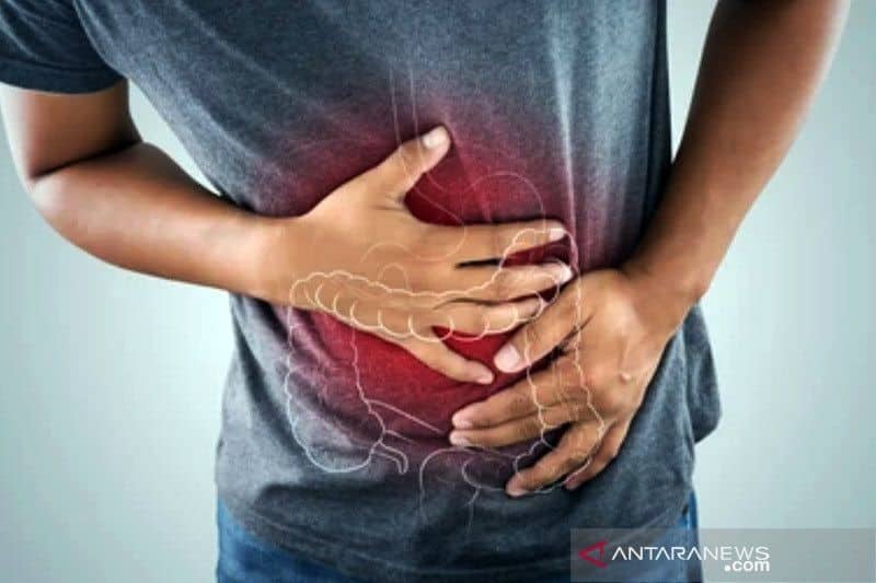 Ilustrasi berita Kesehatan: Kenali Perbedaan Wasir dan Kanker Usus Besar
