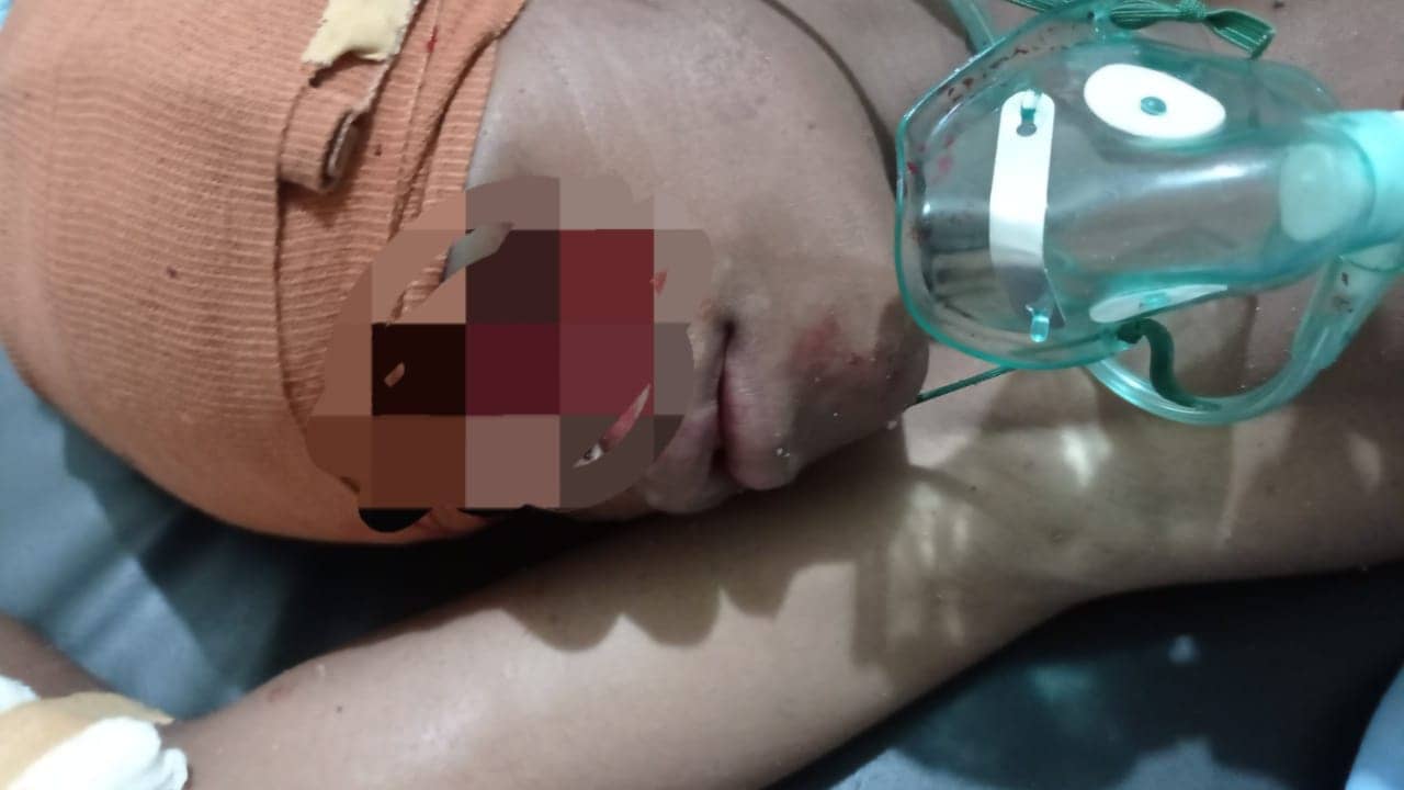 Korban tabrakan tidak sadarkan diri di RSUD Mimika