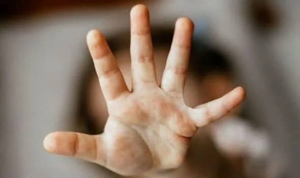 Ilustrasi berita Mimika: Anak Dibawah Umur di Timika Disetubuhi 3 Pria, Dua Pelaku Bapak dan Kakak Angkat, Satu Lagi Oknum Guru