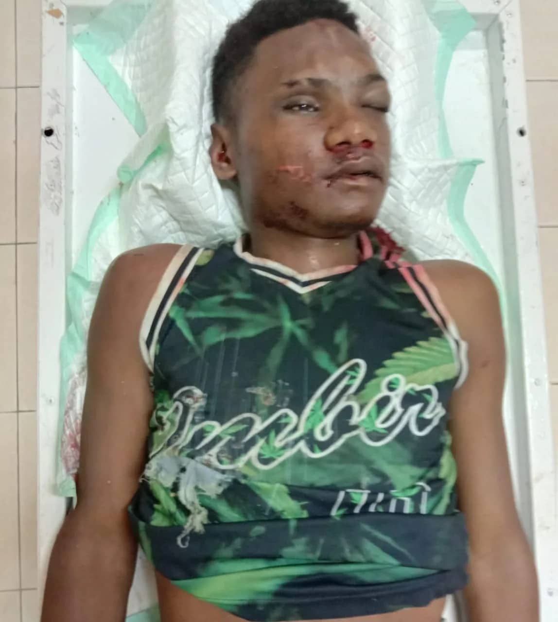 Ilustrasi berita Mimika: Seorang Pemuda Tewas Dalam Kecelakaan di Kilo 10 Timika, Jenazah Ada di RSUD, Mungkin Ada yang Kenal ?