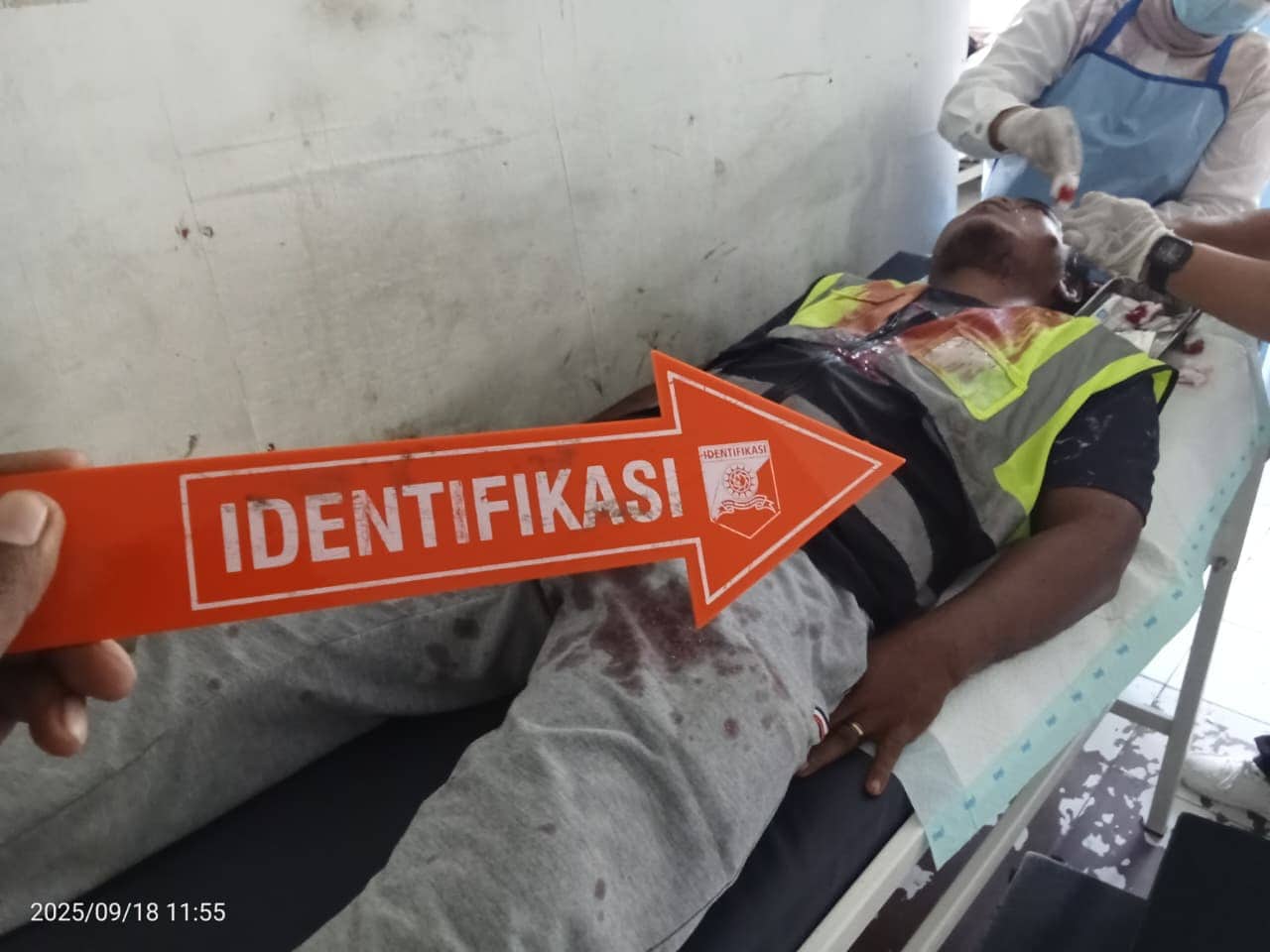 Ilustrasi berita BERITA UTAMA: Pekerja Proyek di Yahukimo Dikeroyok 15 Orang, Alami Luka Serius di Kepala Akibat Tebasan Parang