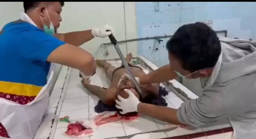 Ilustrasi berita JAYAPURA: Sadis! Seorang Pria Ditemukan Tewas di Holtekamp Dengan Kapak Masih Menancap di Kepala, Polisi: Itu Hoaks