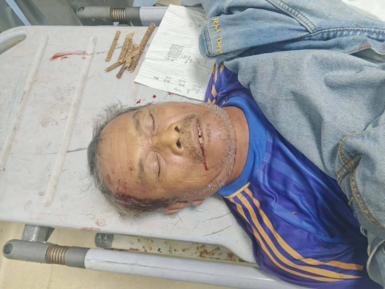 Ilustrasi berita Mimika: Tewas Akibat Lakalantas di Jalan Ujung Bandara Timika, Jenazah Mr X Tersimpan di Kamar Jenazah RSUD Mimika