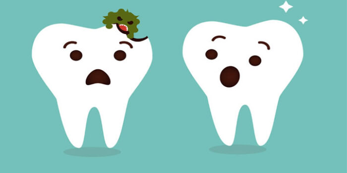 4 Cara atasi Ngilu pada gigi