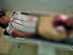 Kabur Saat Ditangkap, Peluru Terpaksa ‘Bersarang’ di Kaki Pelaku Pembunuhan di Kumbe