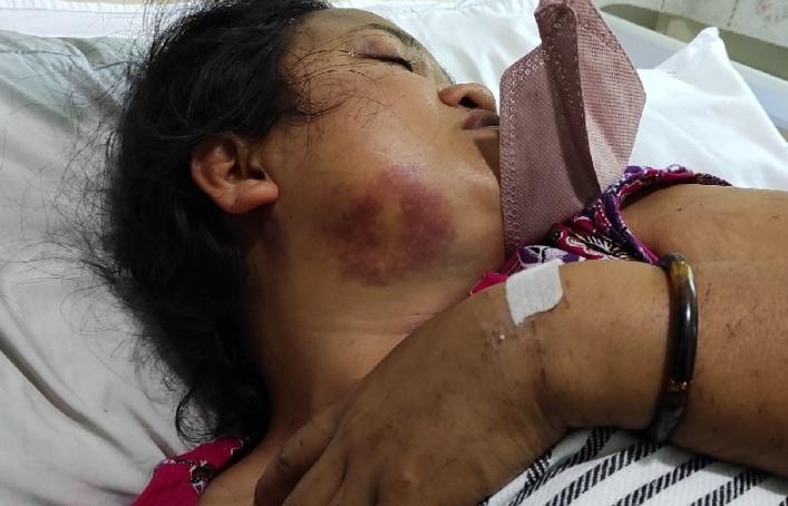 Salah satu nakes yang dianiaya KKB di Kiwirok, Kabupaten Pegunungan Bintang, yakni Kristina Sampe Tonapa mengalami luka disekujur tubuh masih dirawat di RS Marthen Indey, Jayapura