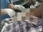 Petugas medis sedang mengeluarkan benda sejenis kain dari perut korban.