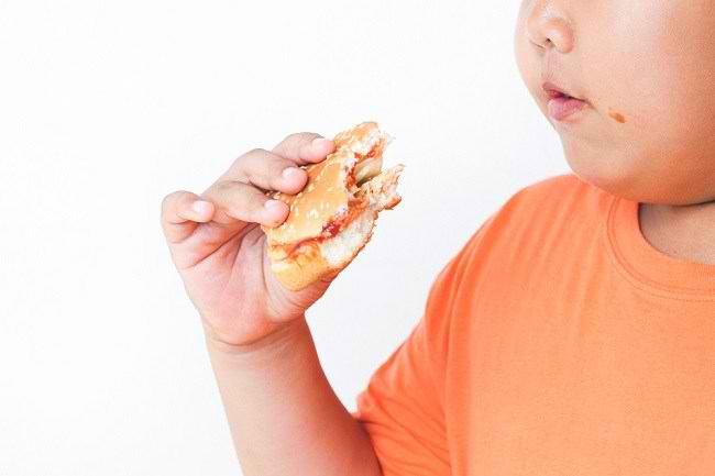Mengetahui Penyebab Anak Obesitas dan Cara Mengatasinya