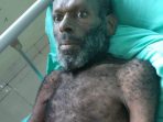 Marthen Wenda Terlantar di Kalimantan, Sekda Papua Tugaskan Kadis Sosial Segera Jemput