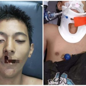 Flashnews, Seorang Pemuda Tewas Usai Kecelakaan di Jalan Budi Utomo Ujung, Mungkin Ada yang Kenal?