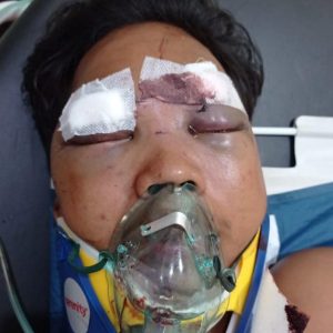 Seorang Pria Kritis Ditemukan di Kilometer 8, Dokter RSUD Mimika Lakukan Operasi, Mungkin Ada yang Kenal ?