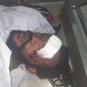 Mungkin Ada Warga Mimika yang Kehilangan Anggota Keluarga? Sudah 2 Hari Ada Jenazah Tanpa Identitas di RSUD Mimika
