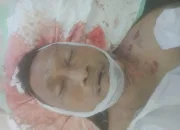 Jenazah Tanpa Identitas di RSUD Mimika Diduga Korban Kecelakaan Lalulintas, Ada yang Kenal?