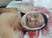 Terungkap, Ini Identitas Jenazah Tak Dikenal yang Terbaring di RSUD Mimika
