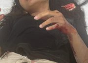 Seorang Wanita Korban Penjambretan Dilarikan ke RSUD Mimika