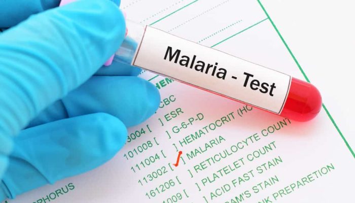 Percepat Layanan, Pemeriksaan Malaria di Puskesmas Kini Kurang dari 35 Menit